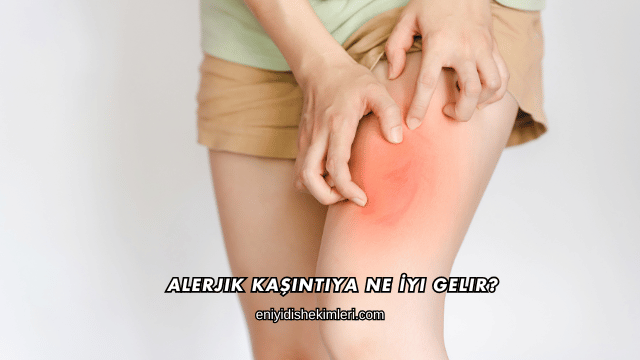 Alerjik Kaşıntıya Ne İyi Gelir?