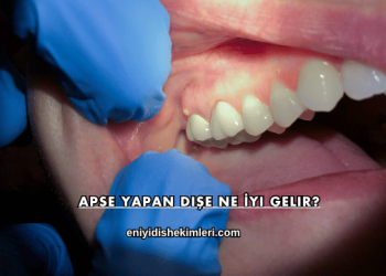 Apse Yapan Dişe Ne İyi Gelir?