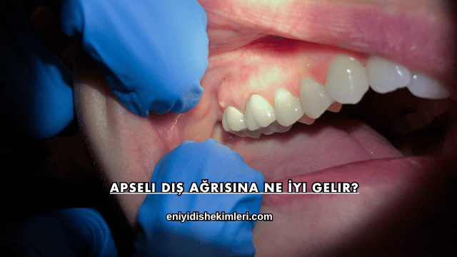 Apseli Diş Ağrısına Ne İyi Gelir?