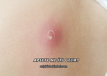 Apseye Ne İyi Gelir?
