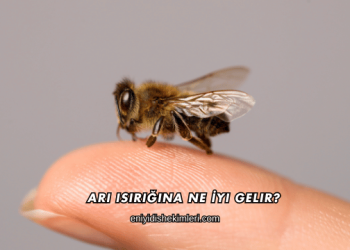 Arı Isırığına Ne İyi Gelir?