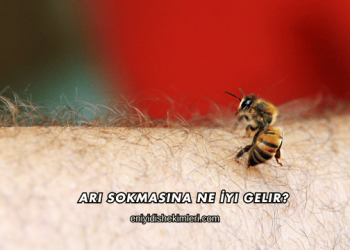 Arı Sokmasına Ne İyi Gelir?