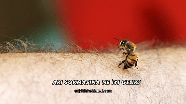 Arı Sokmasına Ne İyi Gelir?