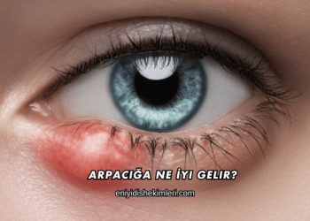 Arpacığa Ne İyi Gelir?