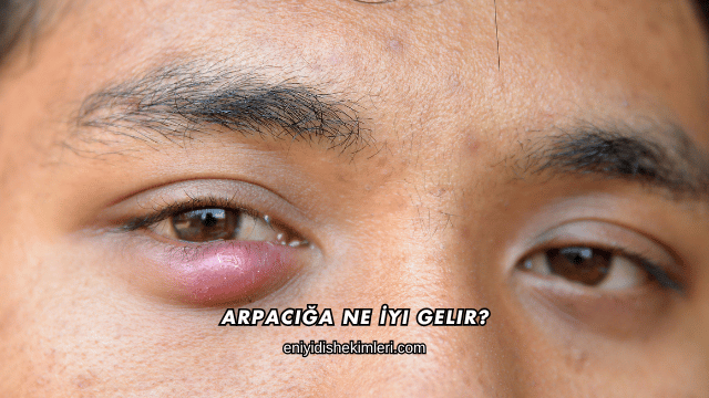 Arpacığa Ne İyi Gelir?