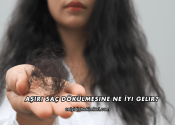 Aşırı Saç Dökülmesine Ne İyi Gelir?