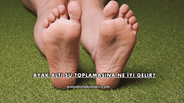 Ayak Altı Su Toplamasına Ne İyi Gelir?