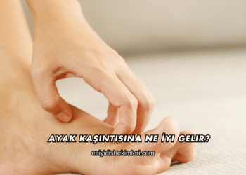 Ayak Kaşıntısına Ne İyi Gelir?