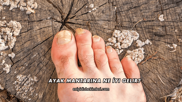 Ayak Mantarına Ne İyi Gelir?