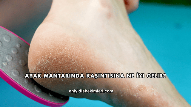 Ayak Mantarında Kaşıntısına Ne İyi Gelir?