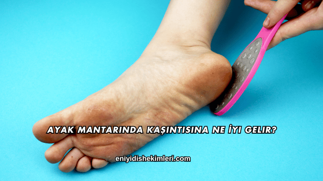 Ayak Mantarında Kaşıntısına Ne İyi Gelir?