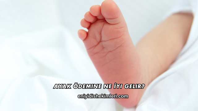 Ayak Ödemine Ne İyi Gelir?