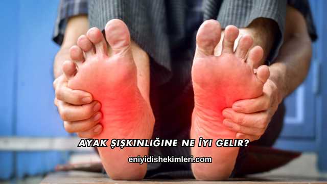 Ayak Şişkinliğine Ne İyi Gelir?