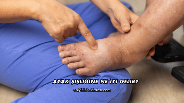 Ayak Şişliğine Ne İyi Gelir?