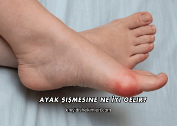 Ayak Şişmesine Ne İyi Gelir?