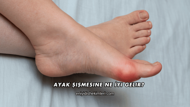 Ayak Şişmesine Ne İyi Gelir?