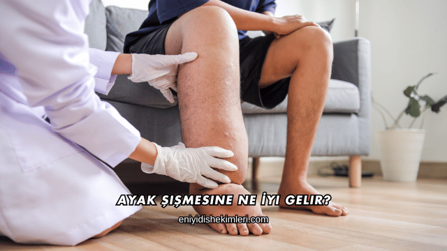 Ayak Şişmesine Ne İyi Gelir?