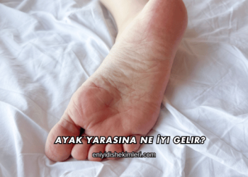Ayak Yarasına Ne İyi Gelir?
