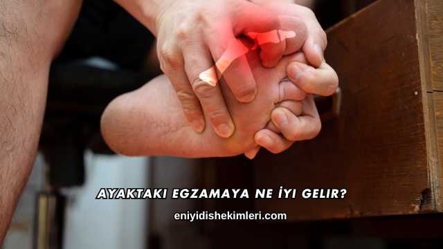 Ayaktaki Egzamaya Ne İyi Gelir?