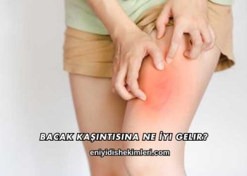 Bacak Kaşıntısına Ne İyi Gelir?