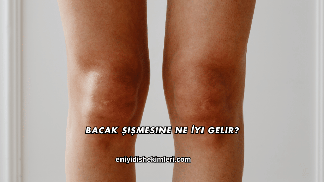 Bacak Şişmesine Ne İyi Gelir?