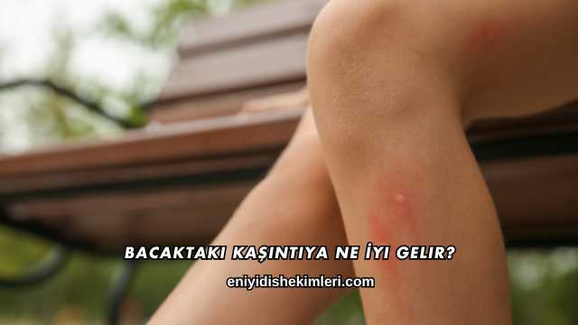 Bacaktaki Kaşıntıya Ne İyi Gelir?