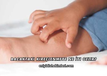 Bacaktaki Kireçlenmeye Ne İyi Gelir?