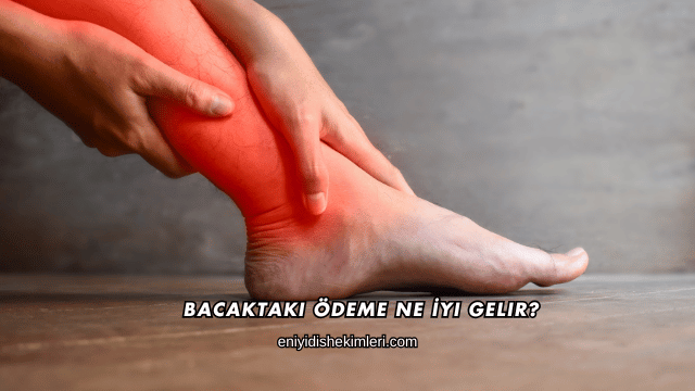 Bacaktaki Ödeme Ne İyi Gelir?