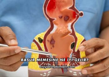 Basur Memesine Ne İyi Gelir?