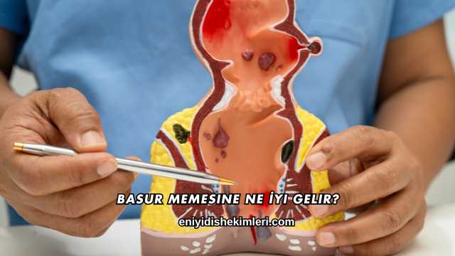 Basur Memesine Ne İyi Gelir?