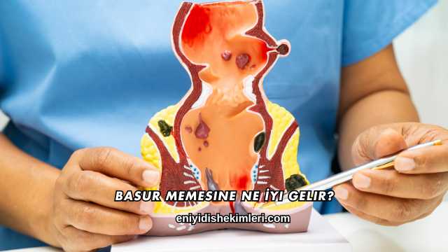 Basur Memesine Ne İyi Gelir?