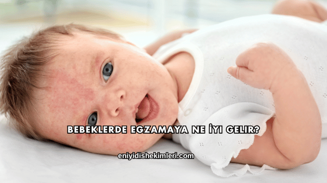 Bebeklerde Egzamaya Ne İyi Gelir?