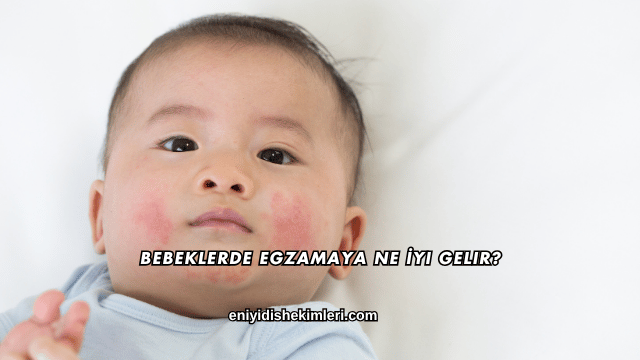 Bebeklerde Egzamaya Ne İyi Gelir?