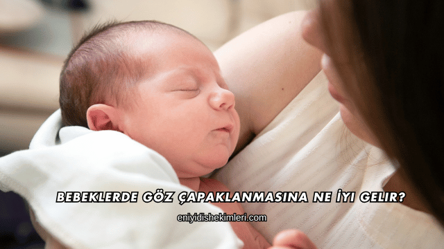 Bebeklerde Göz Çapaklanmasına Ne İyi Gelir?