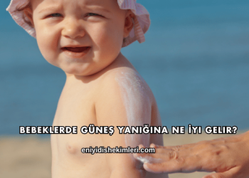 Bebeklerde Güneş Yanığına Ne İyi Gelir?