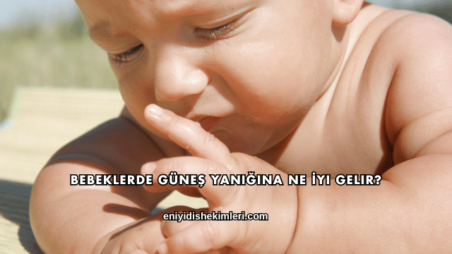 Bebeklerde Güneş Yanığına Ne İyi Gelir?