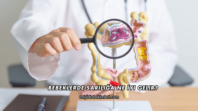 Bebeklerde Sarılığa Ne İyi Gelir?