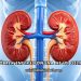 Böbrek Enfeksiyonuna Ne İyi Gelir?