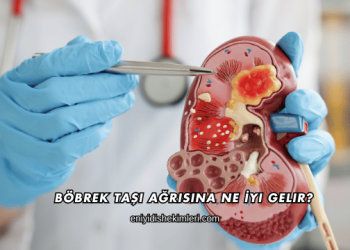 Böbrek Taşı Ağrısına Ne İyi Gelir?