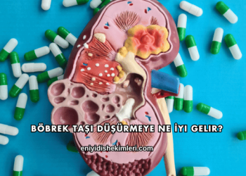 Böbrek Taşı Düşürmeye Ne İyi Gelir?