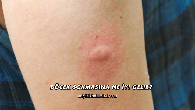 Böcek Sokmasına Ne İyi Gelir?
