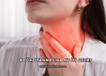 Boğaz Yanmasına Ne İyi Gelir?