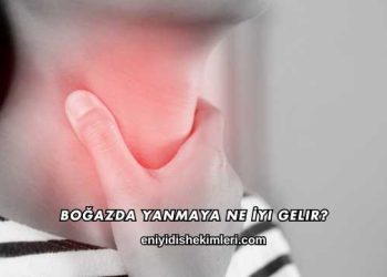Boğazda Yanmaya Ne İyi Gelir?