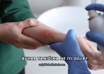 Buhar Yanığına Ne İyi Gelir?