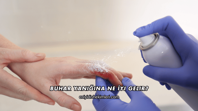 Buhar Yanığına Ne İyi Gelir?