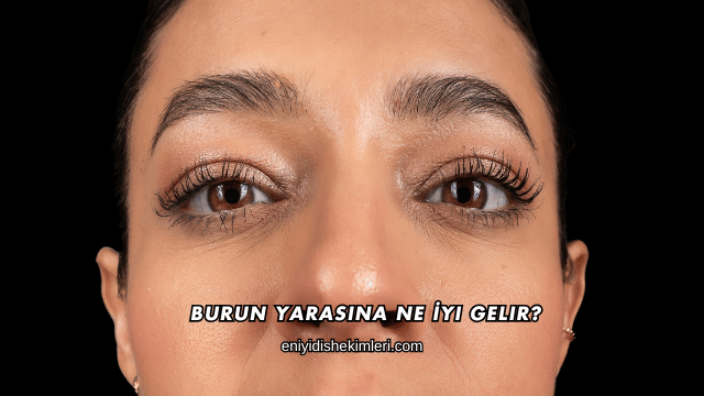 Burun Yarasına Ne İyi Gelir?