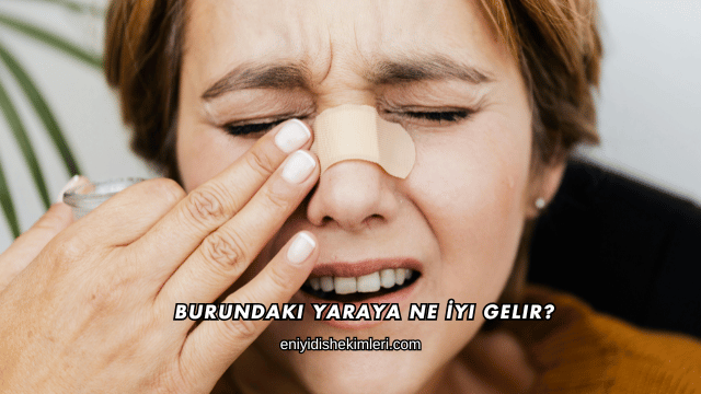 Burundaki Yaraya Ne İyi Gelir?