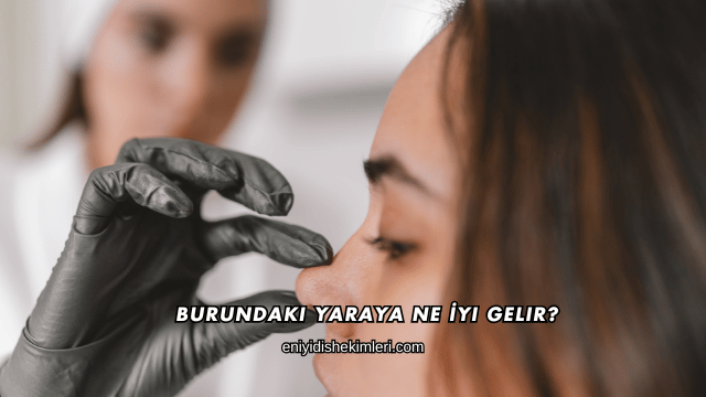 Burundaki Yaraya Ne İyi Gelir?
