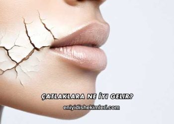 Çatlaklara Ne İyi Gelir?