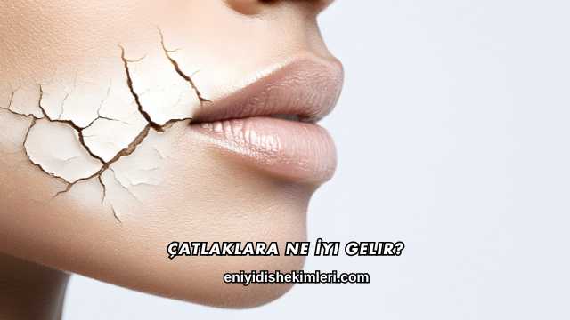 Çatlaklara Ne İyi Gelir?